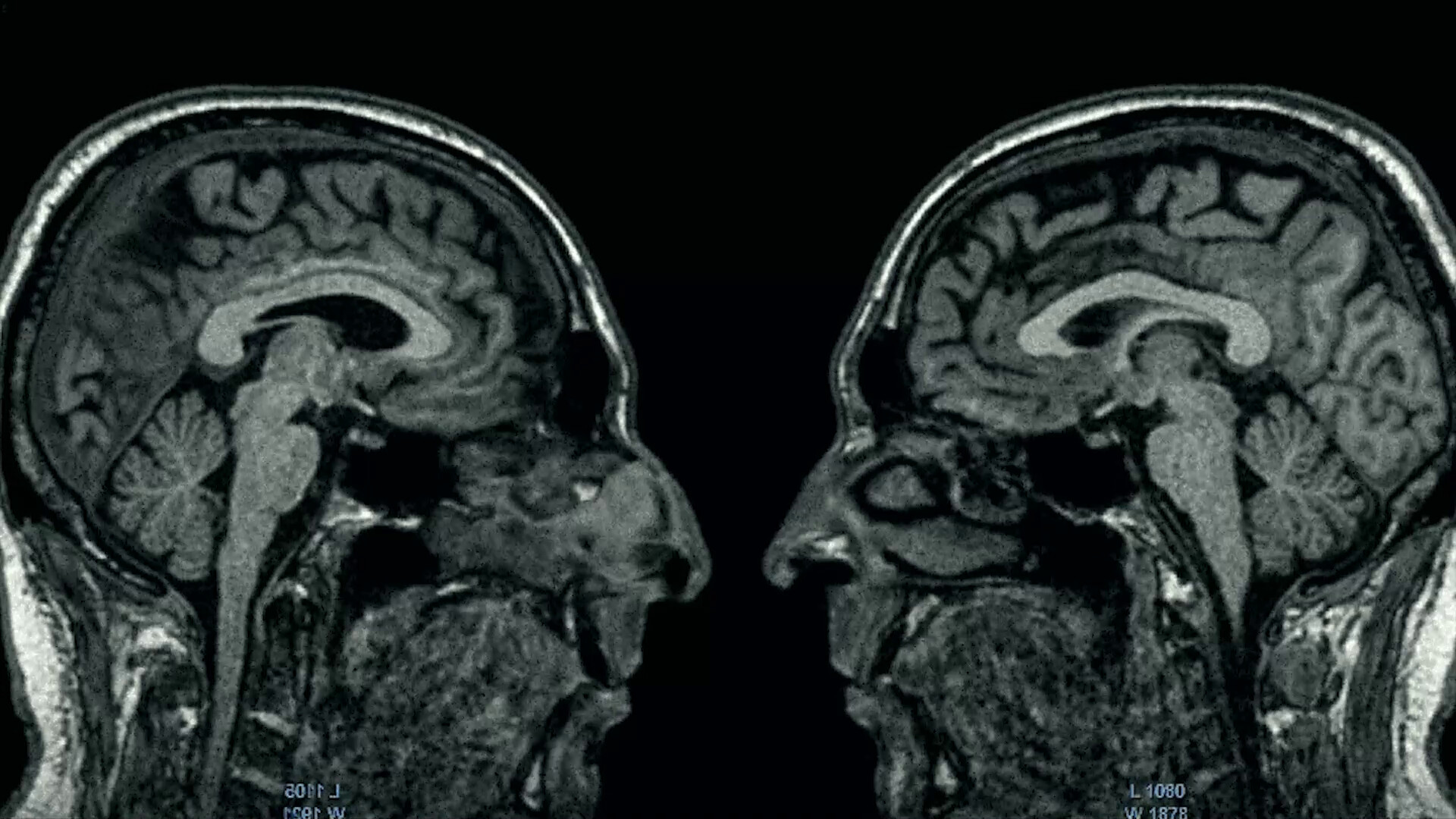 Photo 4 Disfonias_-_Fotograma_5